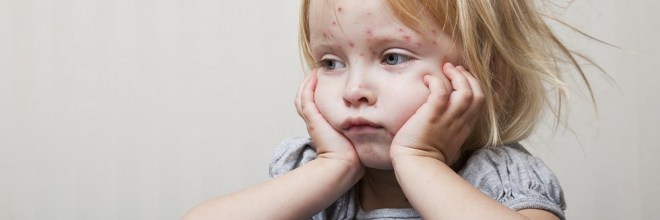 50 Years After Measles Vaccination Was created, US Threat Still High