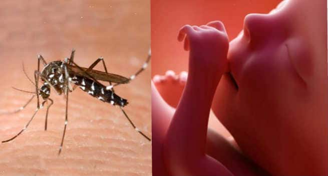 WHO clears up top 4 rumours about Zika virus, including microcephaly